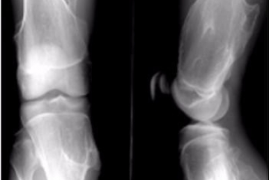 醫用B超/放射膠片—醫用紙質膠片